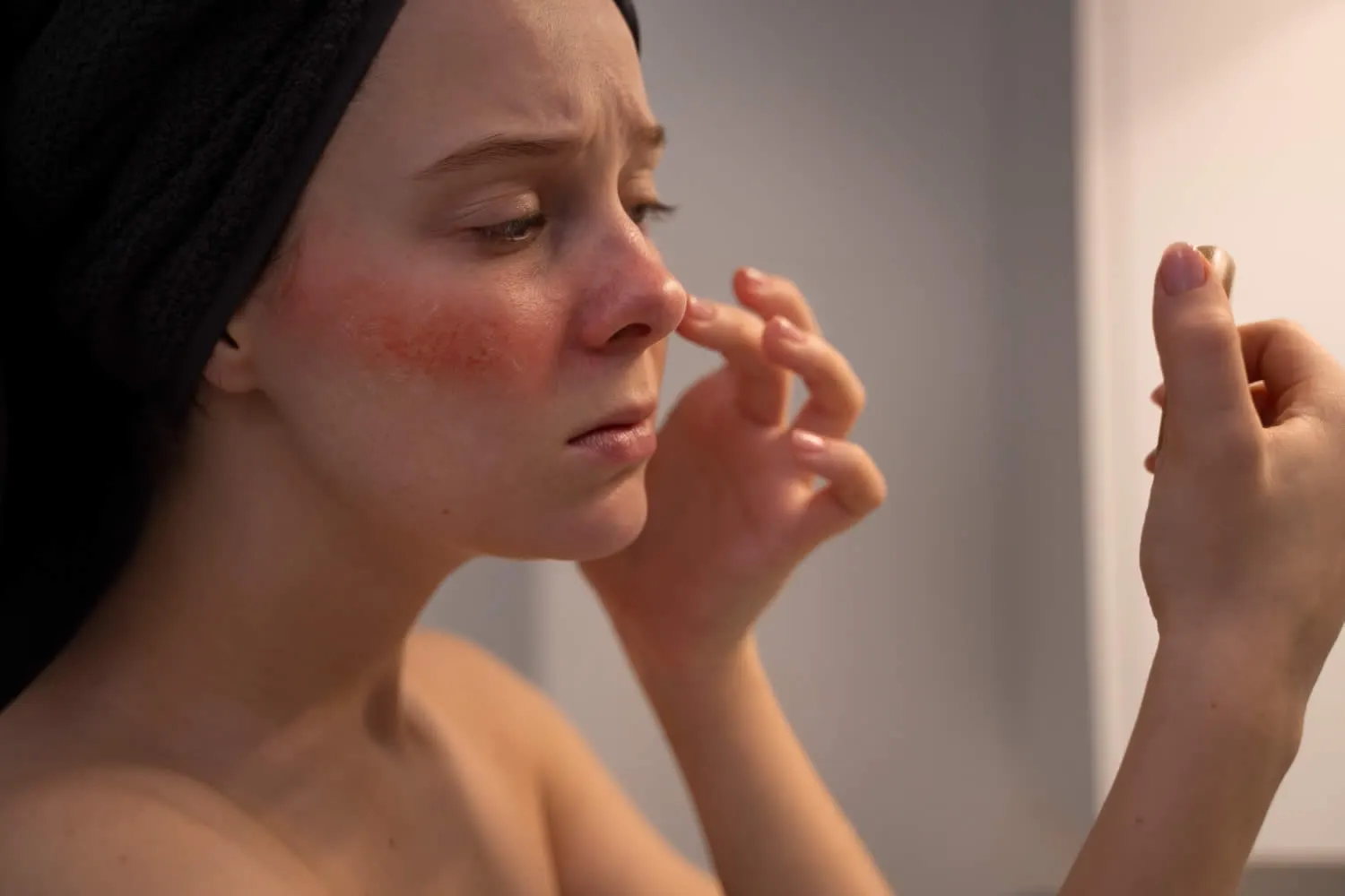 woman-looking-her-rosacea-mirror